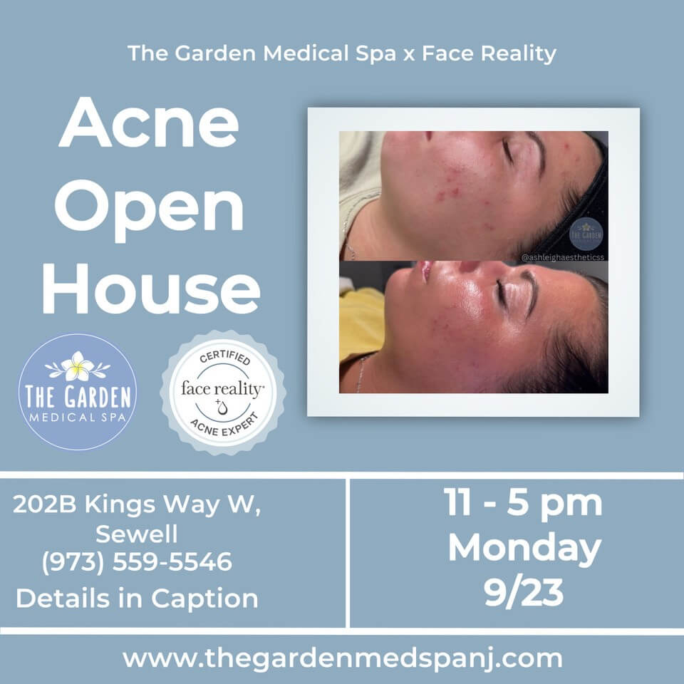 Acne Open House 9.23