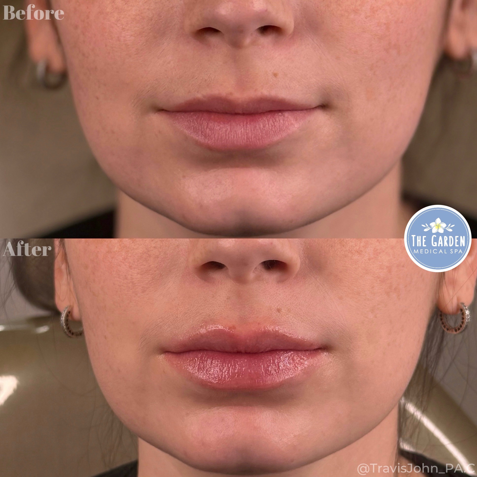 LipGlo Graden Medical Spa